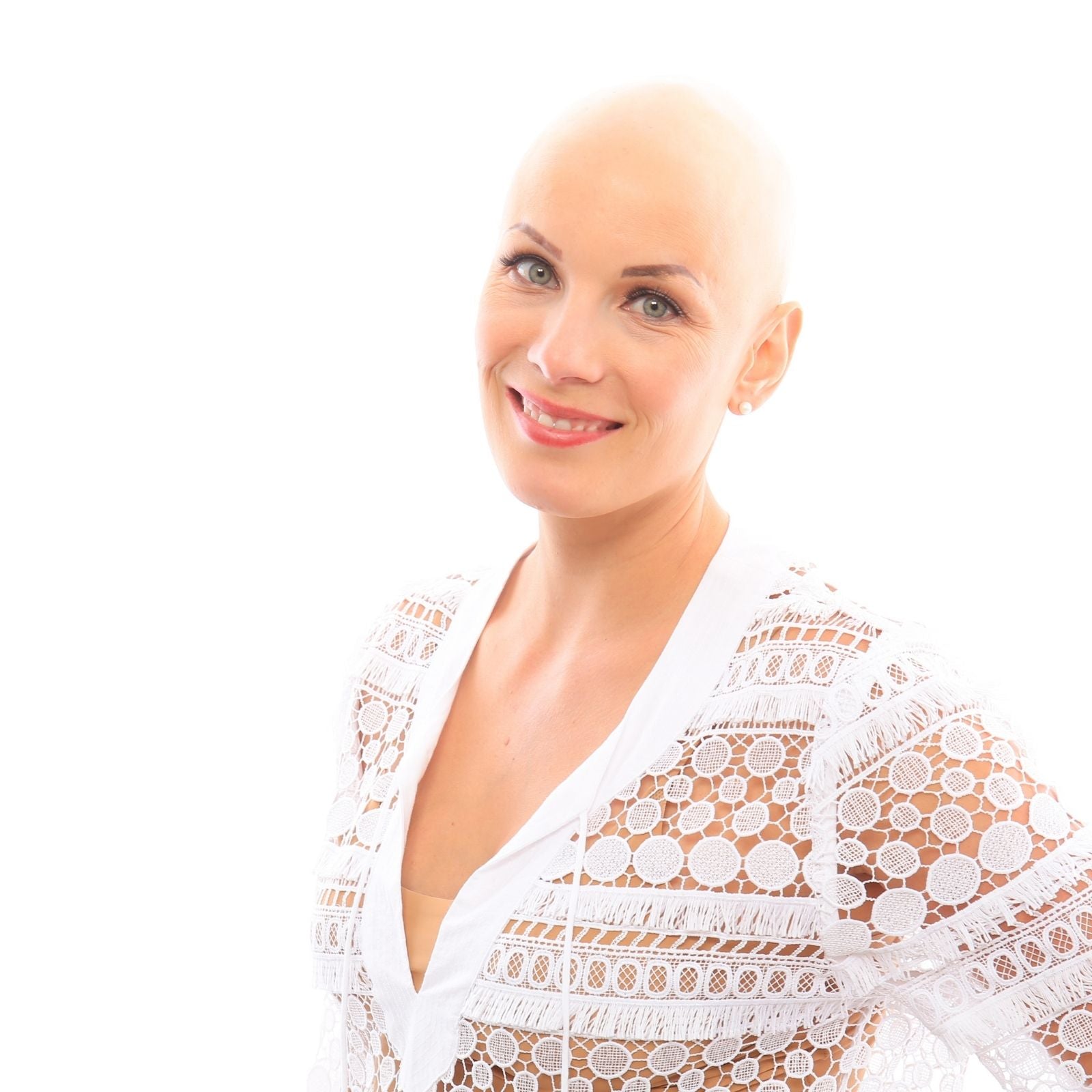 Allison, founder of SPARX, smiling with alopecia universalis
