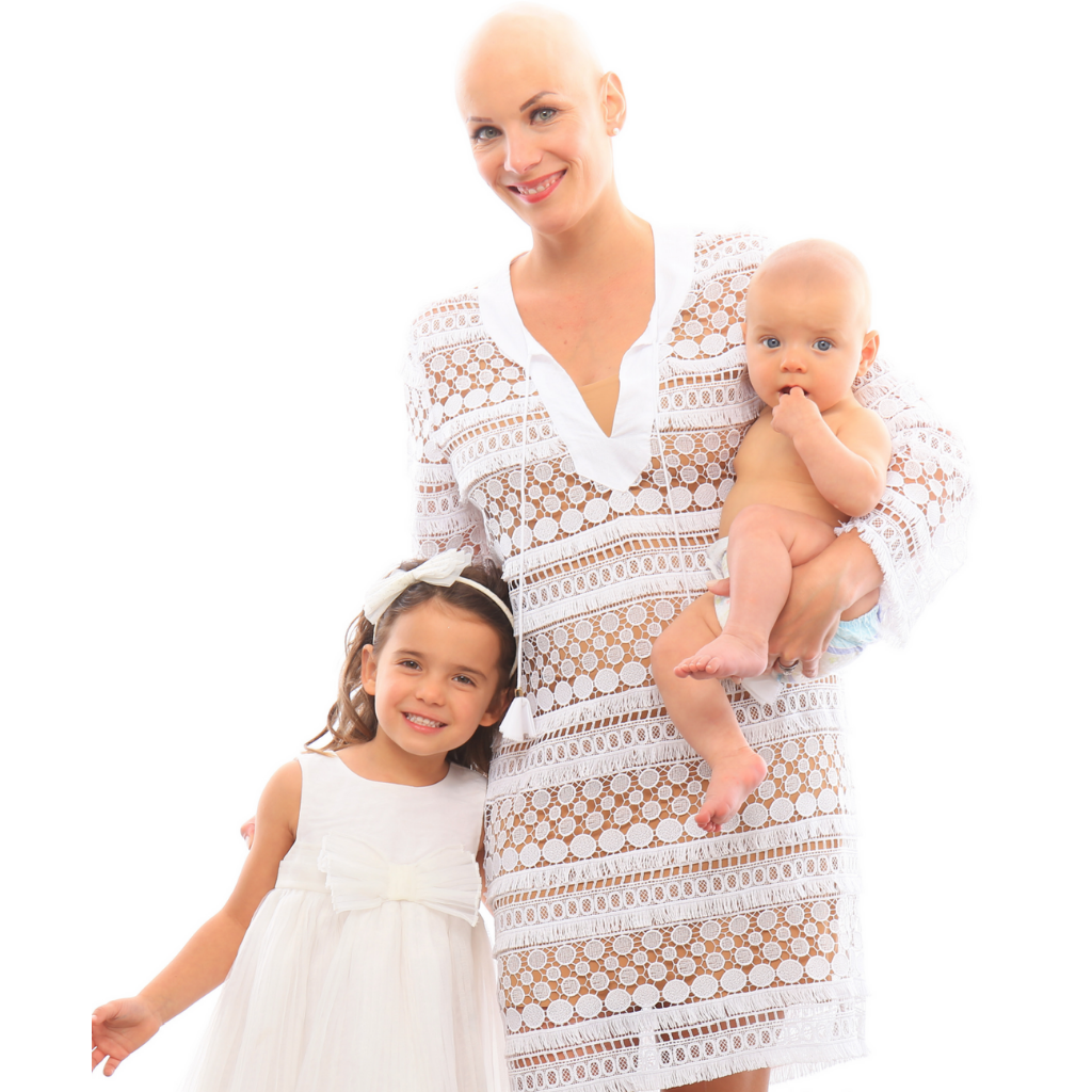 Allison Ombres, Bald Woman, Alopecia