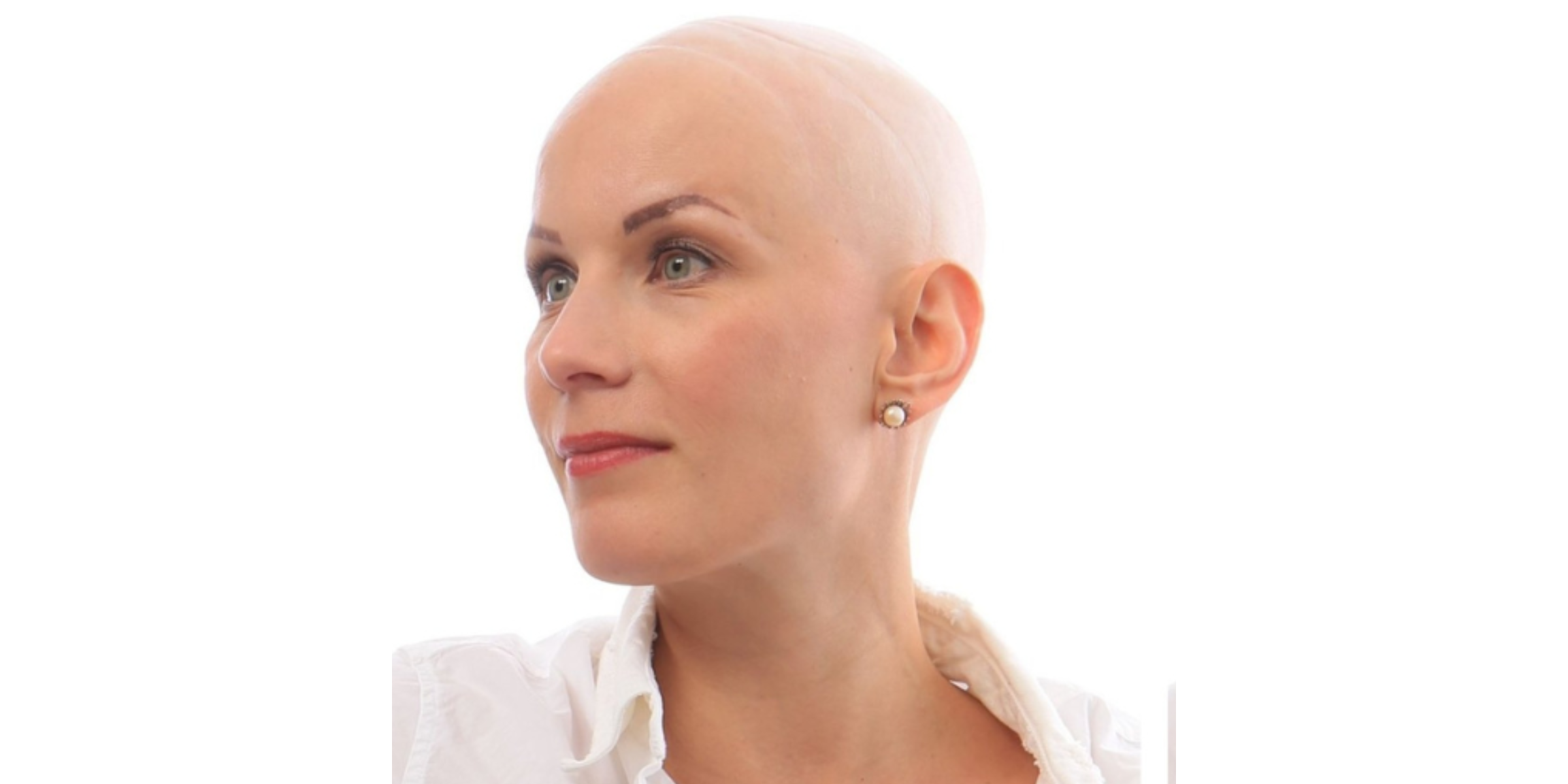 bald women